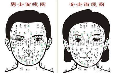 屁股痣|屁股长痣图解与命运分析 痣在屁股有何寓意？